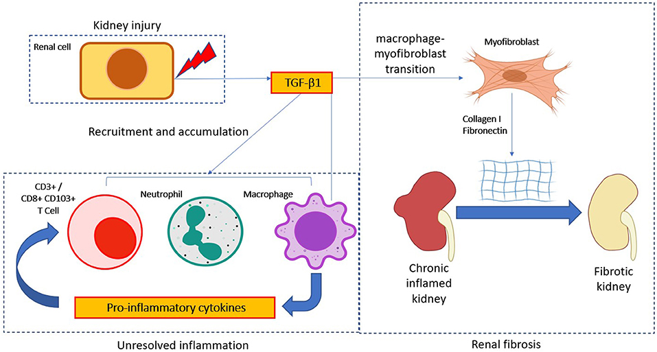 Frontiers | TGF-β1 Signaling: Immune Dynamics of Chronic Kidney 