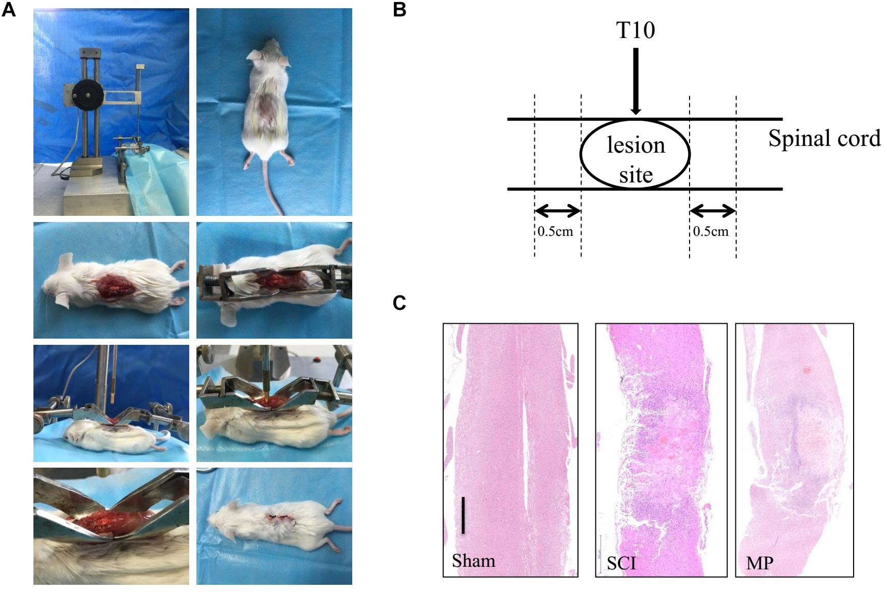 Frontiers | Methylprednisolone Induces Neuro-Protective Effects via the  Inhibition of A1 Astrocyte Activation in Traumatic Spinal Cord Injury Mouse  Models