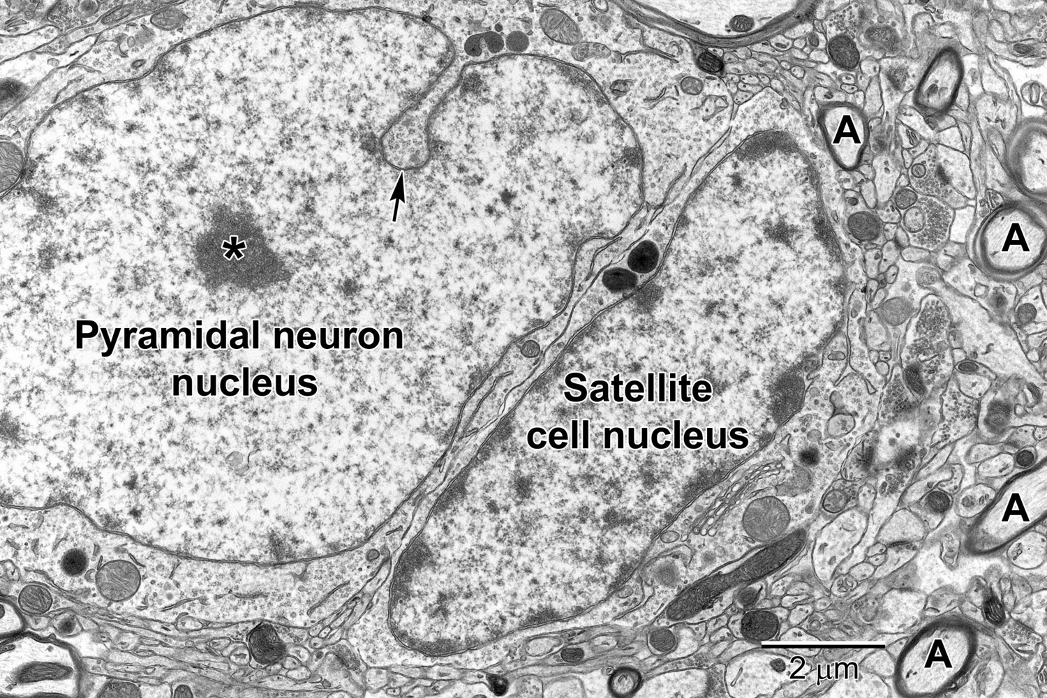 Nerve Cell Electron Microscope