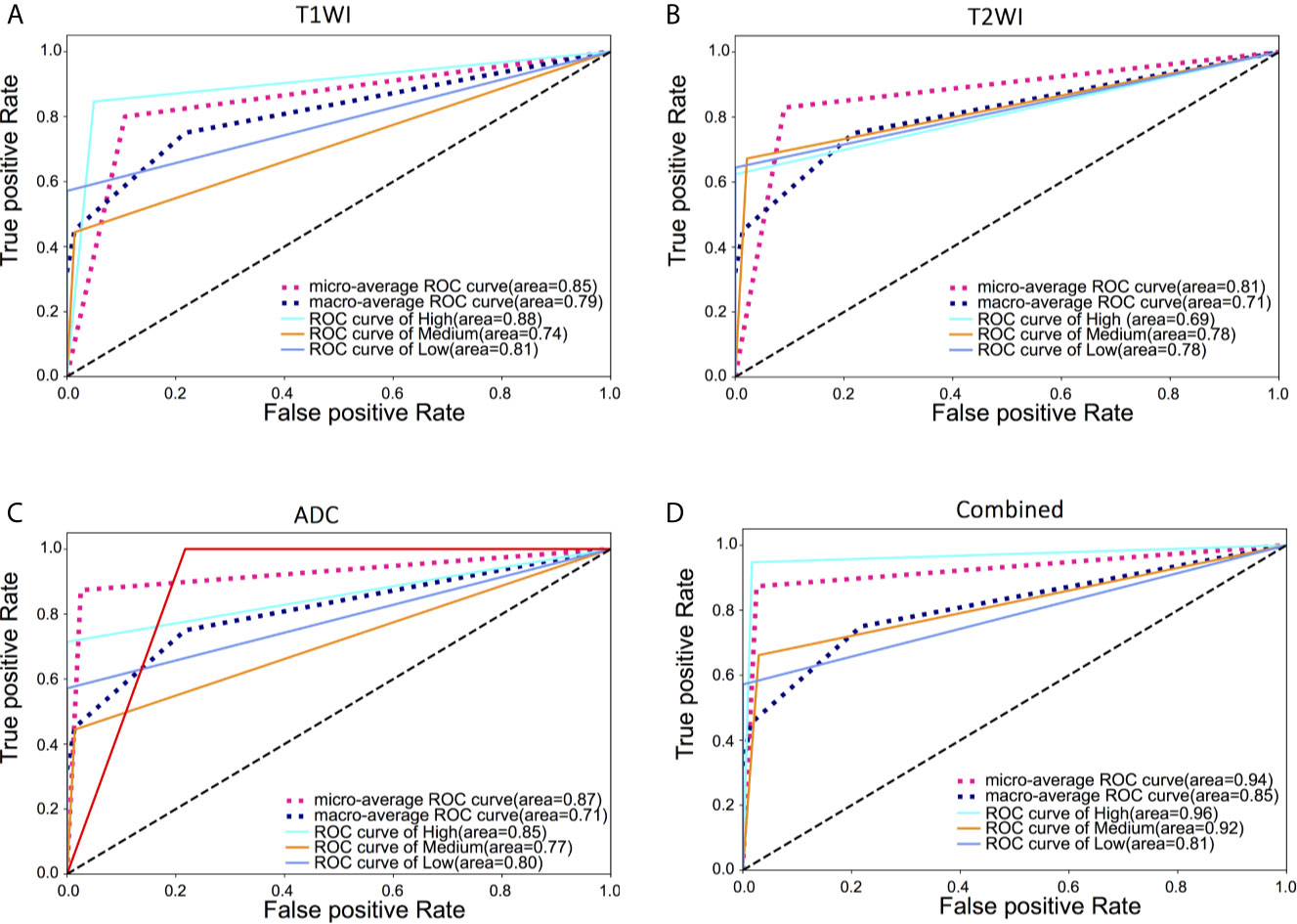 Frontiers | MRI-Based Radiomics Models for Predicting Risk