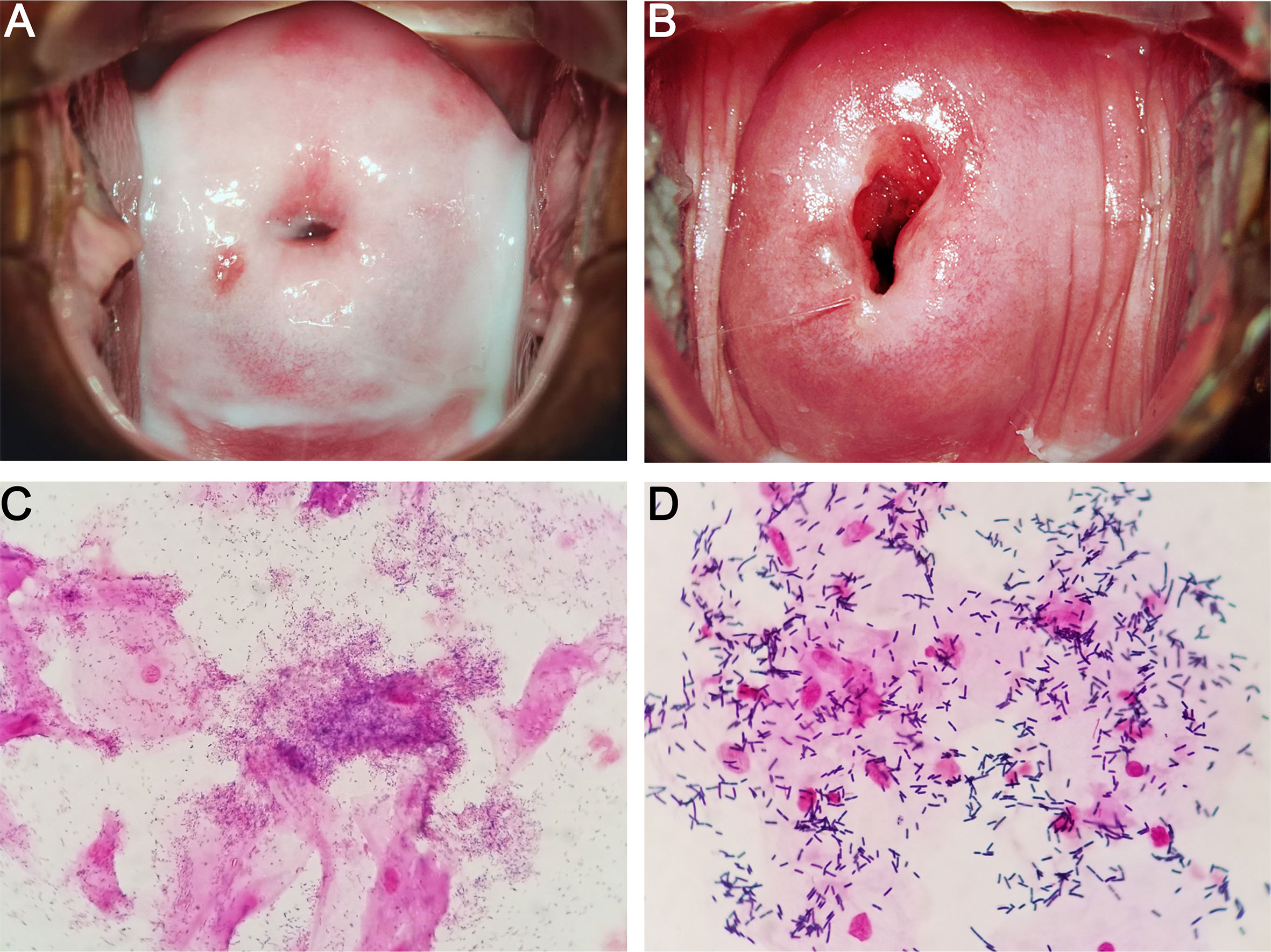 Unveiling the 6 Vaginal Discharge Types: A Complete Breakdown