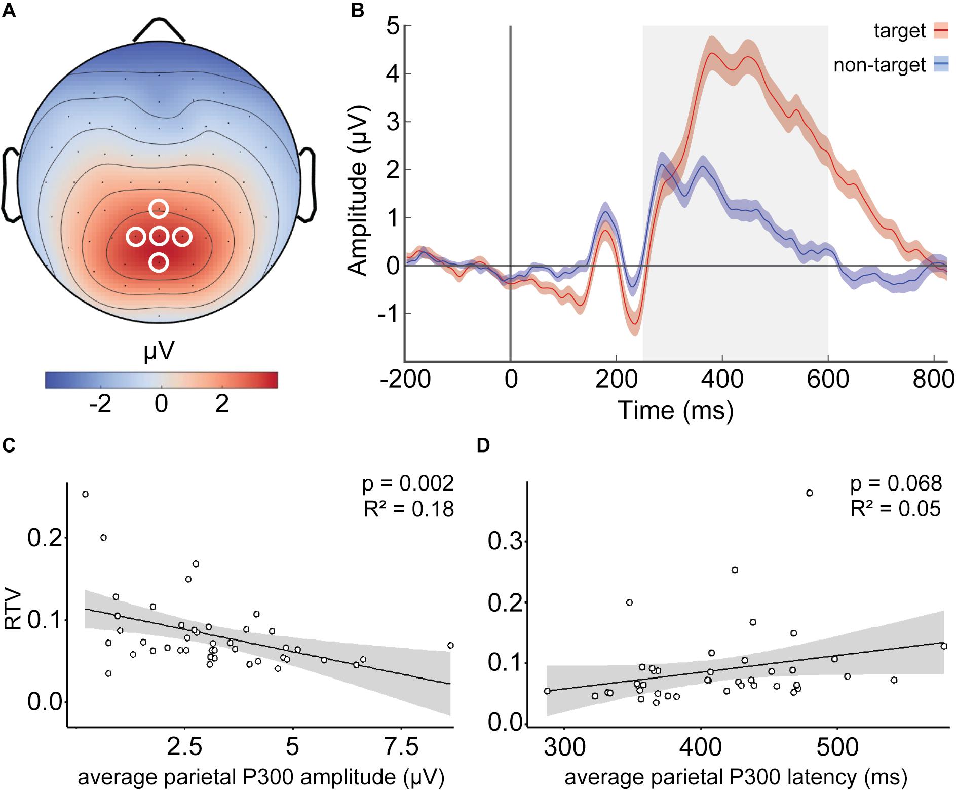 Topographical relocation of adolescent sleep spindles