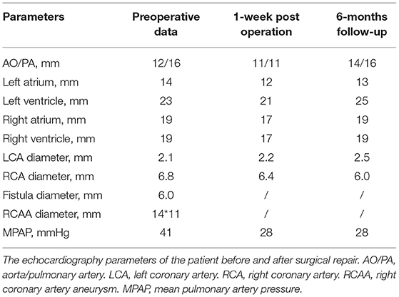 icd 10 code for aneurysm of av fistula