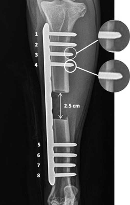 Frontiers Temporal Changes In Reverse Torque Of Locking Head Screws Used In The Locking Plate In Segmental Tibial Defect In Goat Model Surgery
