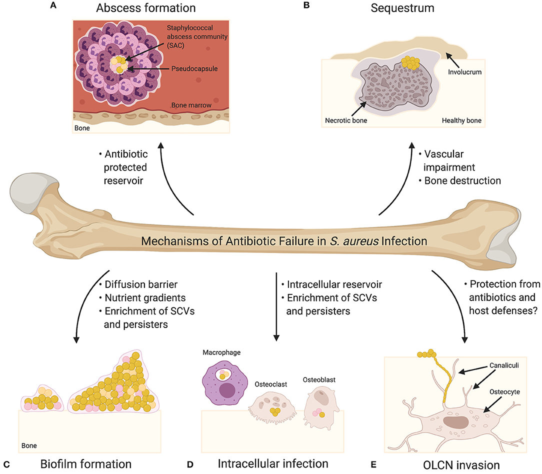 Staphylococcus Aureus, Pathology, Microbiology