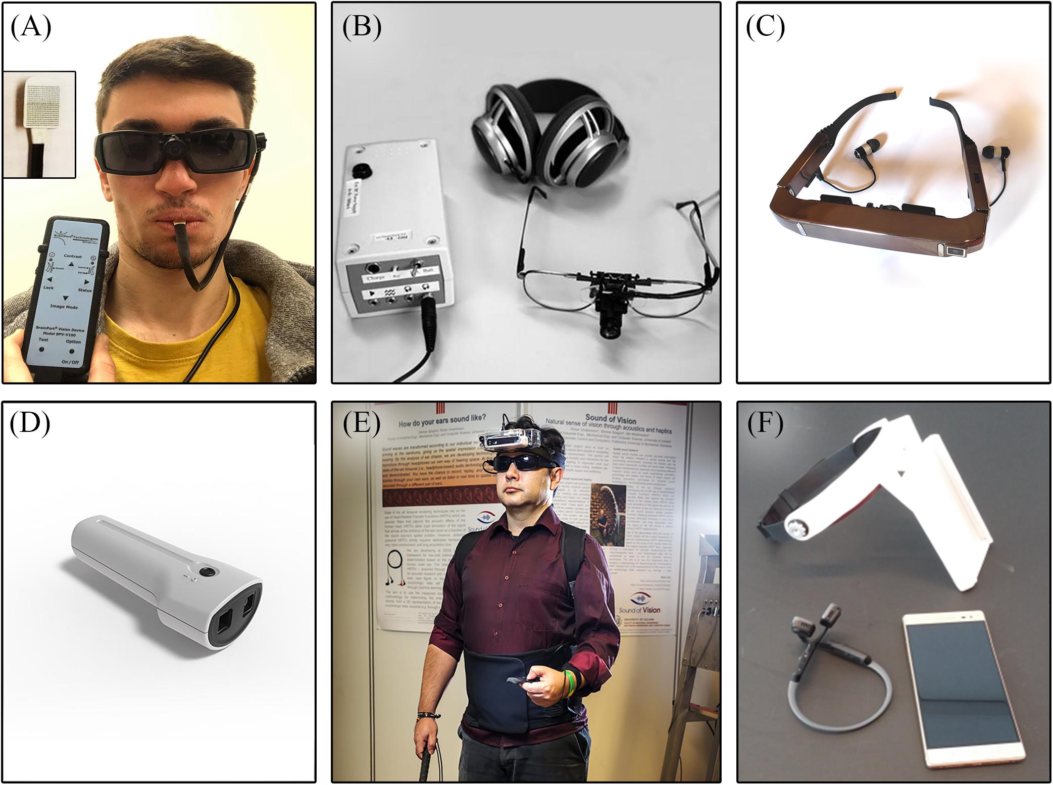 First human implantation of the WFMA for intracortical visual