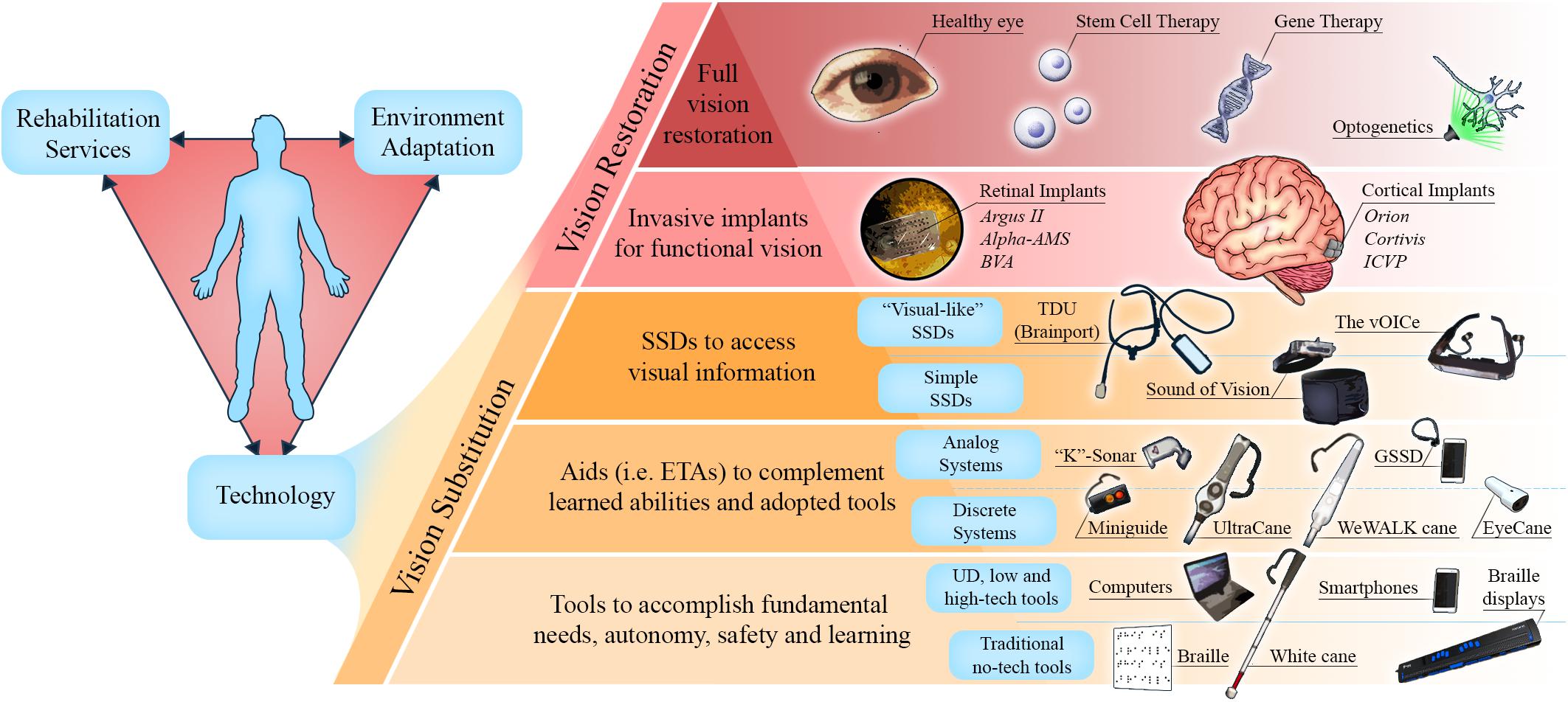 First human implantation of the WFMA for intracortical visual