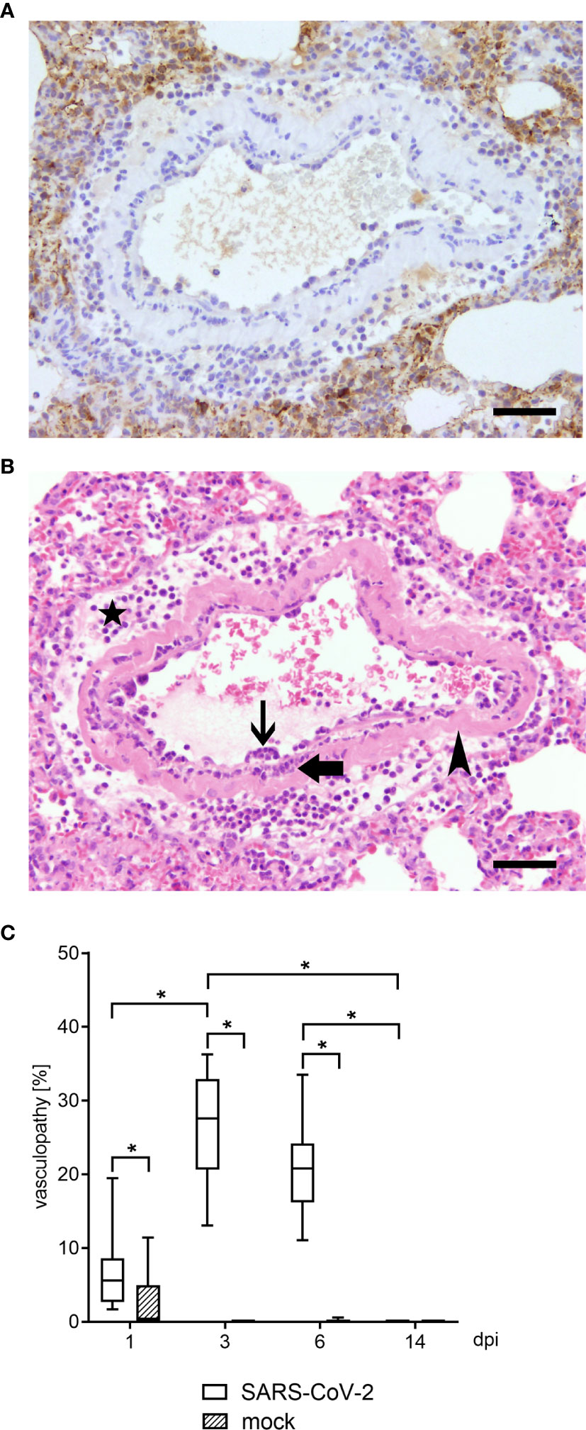 Gender associates with both susceptibility to infection and pathogenesis of SARS-CoV-2 in Syrian hamster