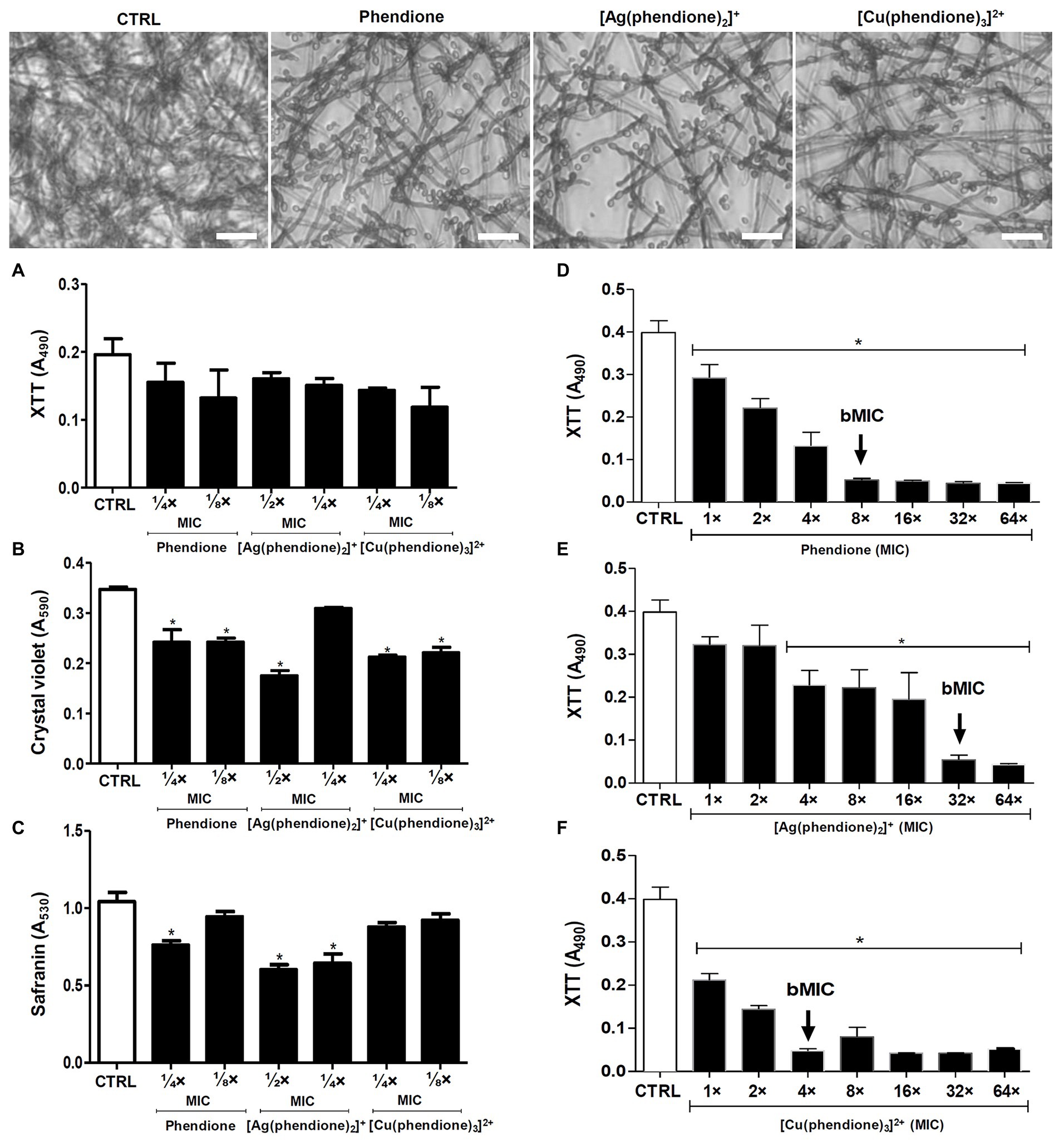 Frontiers Silver I And Copper Ii Complexes Of 1 10 Phenanthroline 5 6 Dione Against Phialophora Verrucosa A Focus On The Interaction With Human Macrophages And Galleria Mellonella Larvae Microbiology
