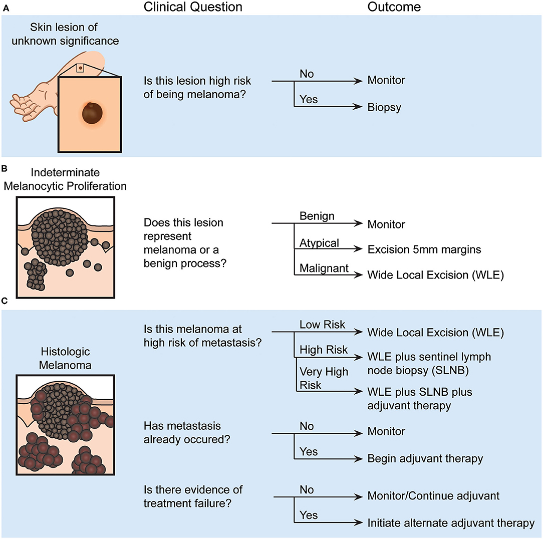 Nanodelivery systems for cutaneous melanoma treatment - ScienceDirect