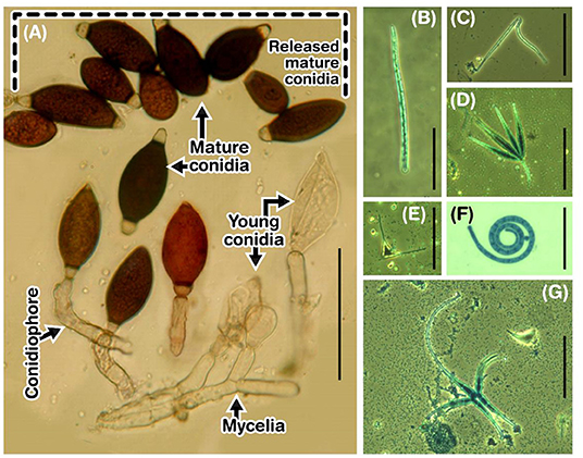 Figure 1 - Microscope photographs of fungi and their spores.