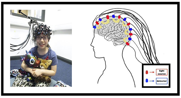 Figure 2 - To study the brain using fNIRS, a stretchy cap with light sources and detectors is placed on the child’s head.
