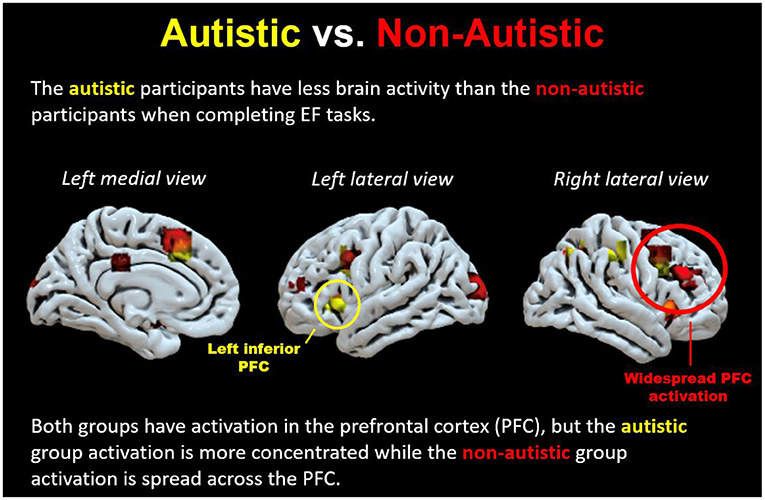 Figure 1 - Brain activation in autistic and non-autistic people during EF tasks, as measured by fMRI.