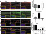 Frontiers | Artemin Is Upregulated by TrkB Agonist and Protects the ...