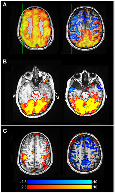 Effects of electrical muscle stimulation on cerebral blood flow, BMC  Neuroscience