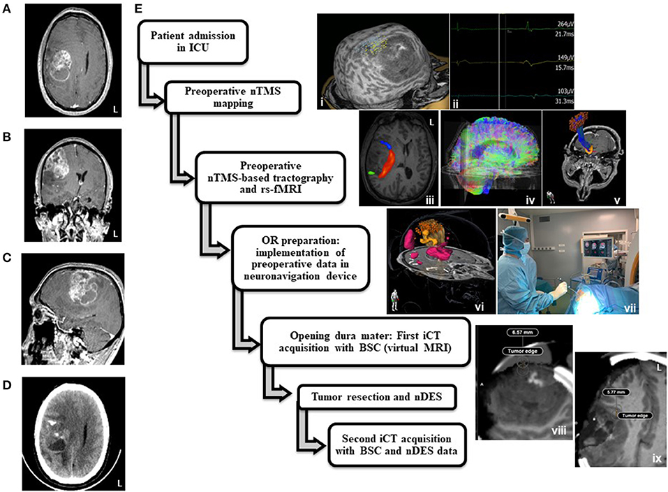 Reorganizations of latency structures within the white matter from