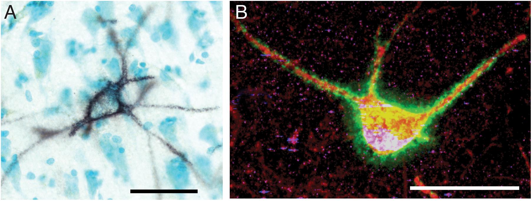 Frontiers | Sleep and Memory Consolidation Dysfunction in Frontiers | Sleep and Memory Consolidation Dysfunction in