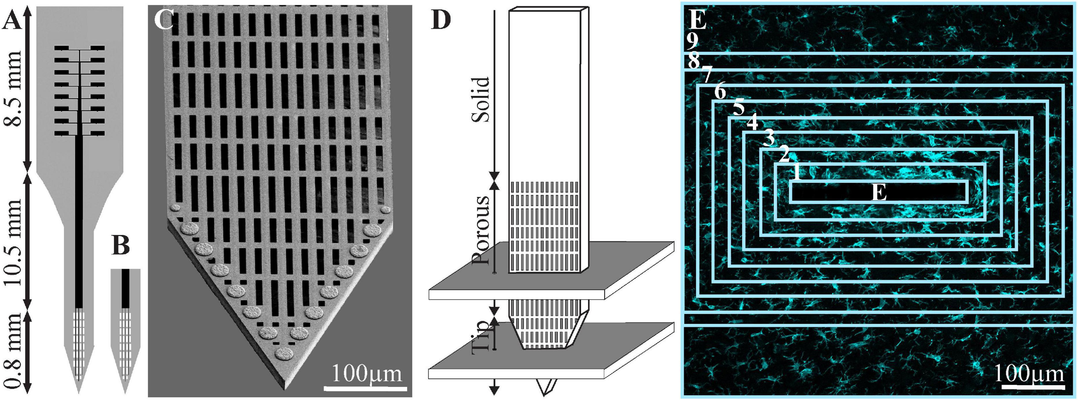 Frontiers  Foreign Body Reaction to Implanted Biomaterials and