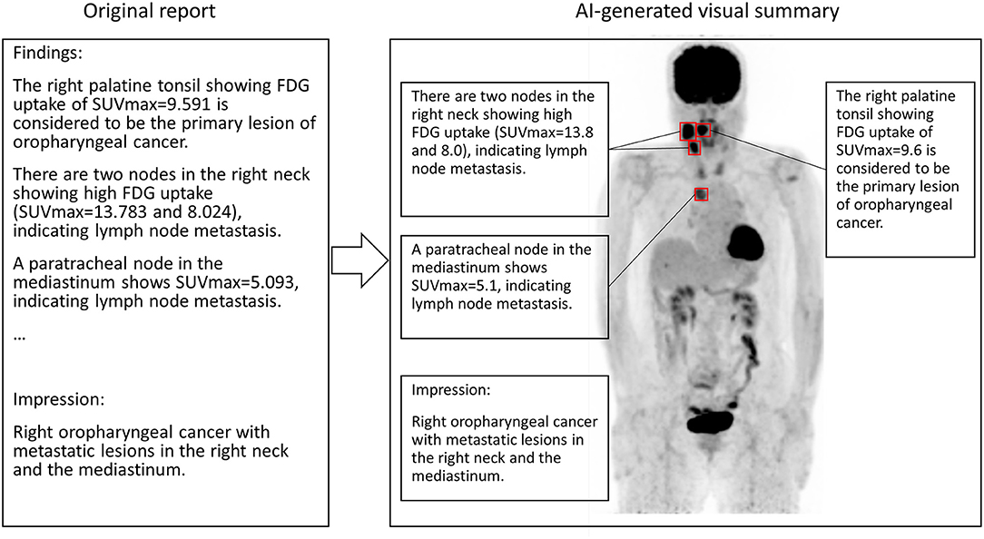 Frontiers | A Preliminary Study Use of FDG PET-CT as an Identifier Lesion for Artificial