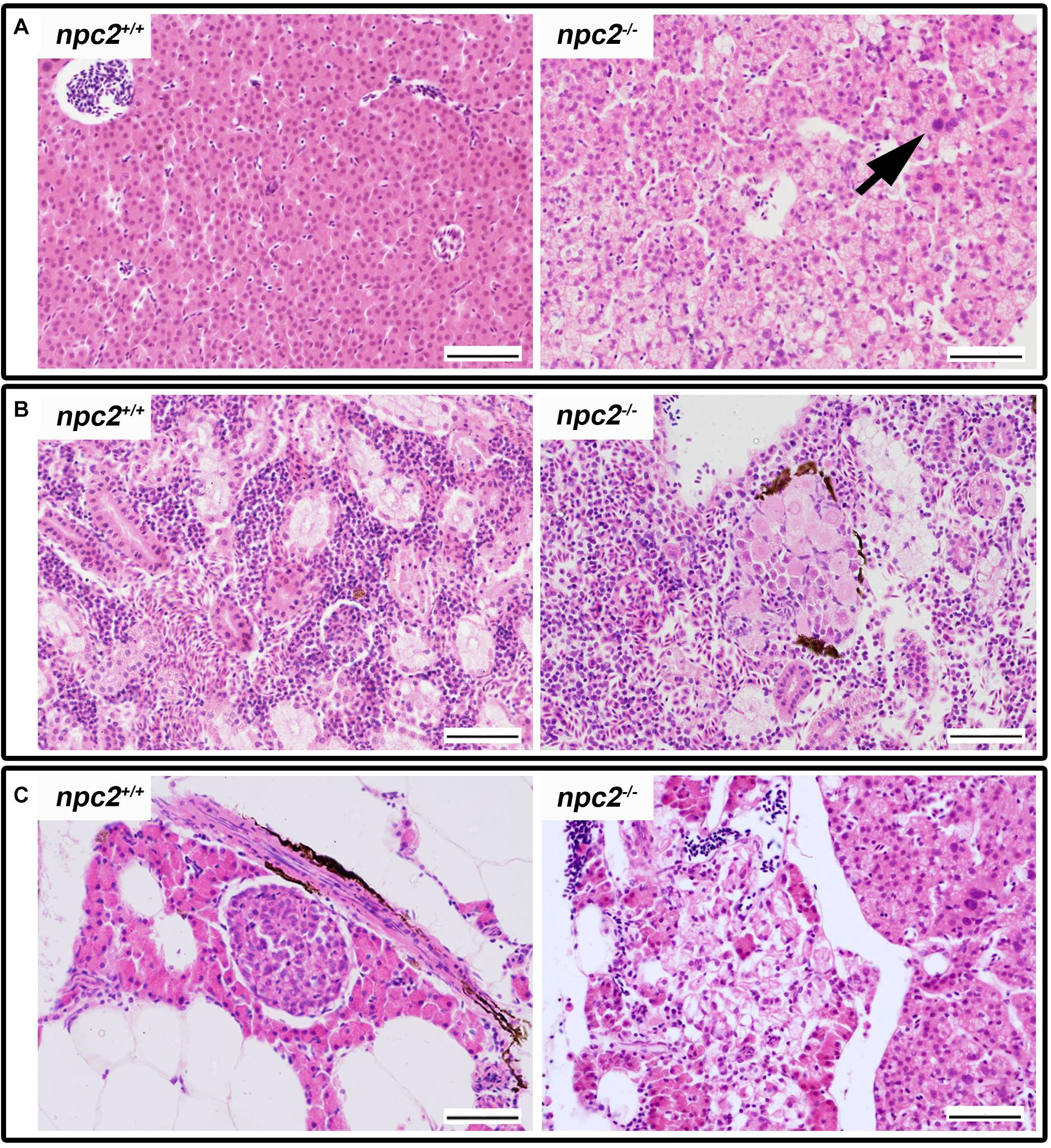 Frontiers  Lysosomal and Mitochondrial Liaisons in Niemann-Pick