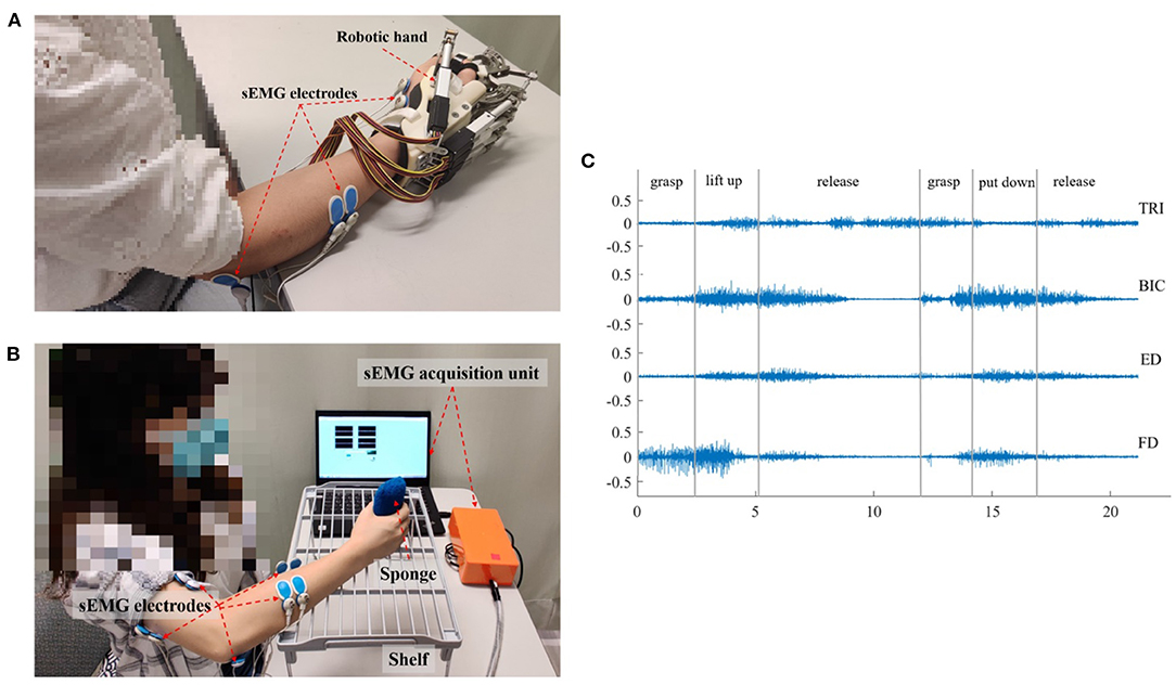 The electromyography (EMG)-driven neuromuscular electrical stimulation