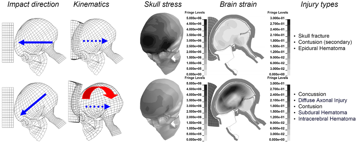 Head injury of types Head injury