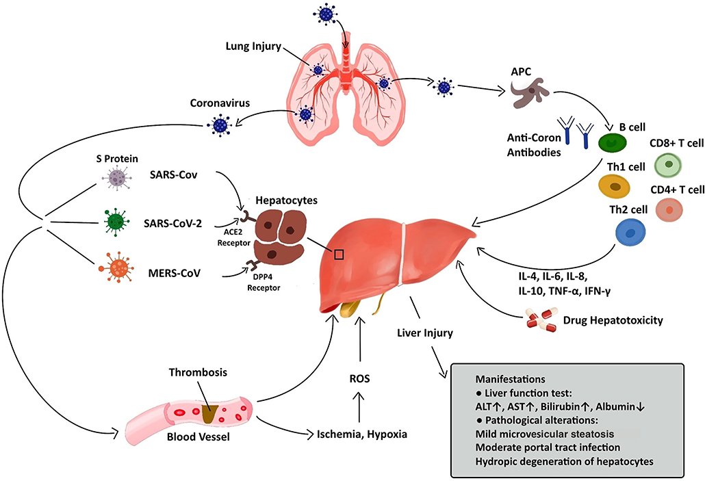 Frontiers  Potential Effects of Coronaviruses on the Liver: An Update