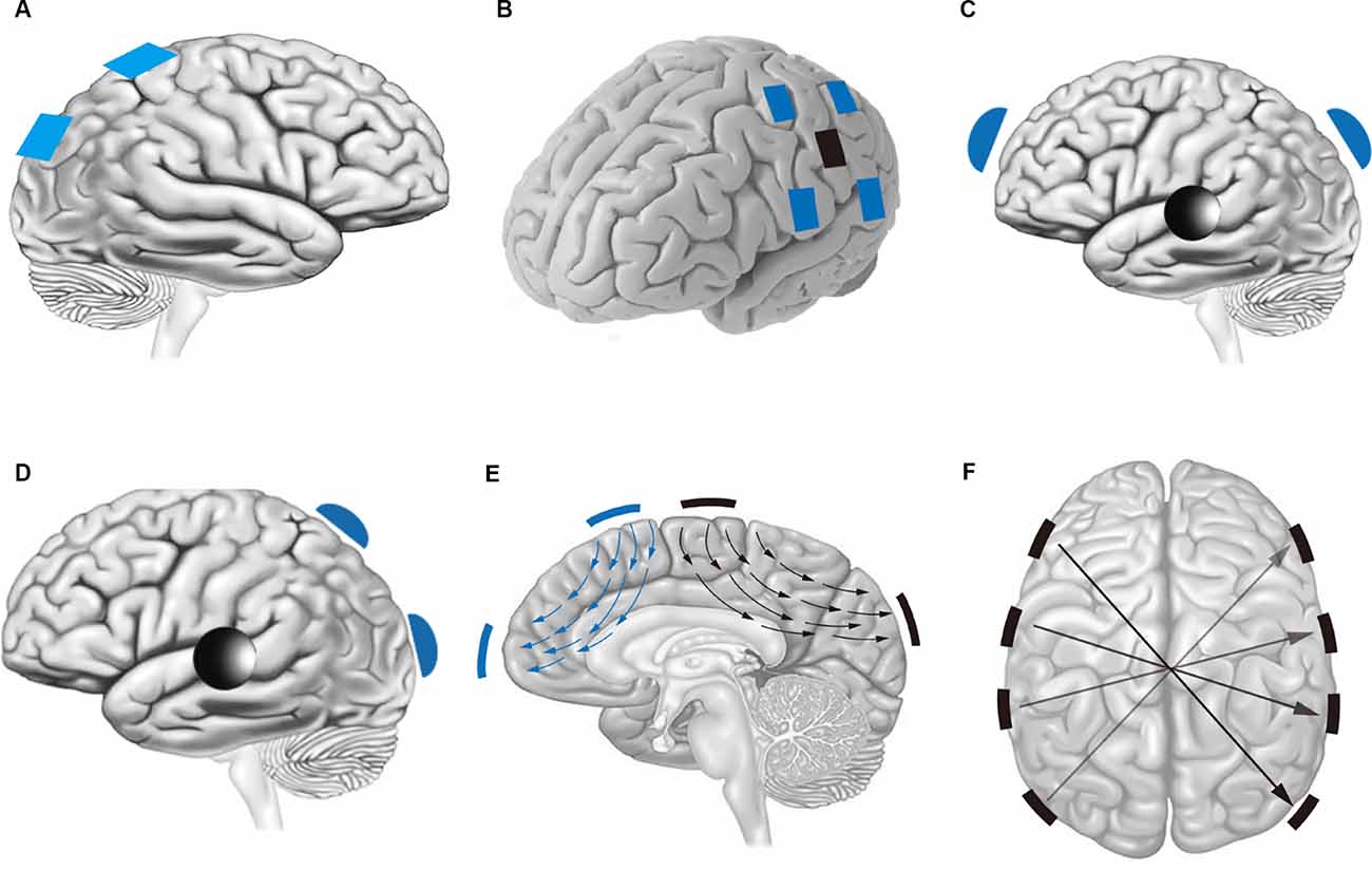 Frontiers  Improving the Effect of Transcranial Alternating Current  Stimulation (tACS): A Systematic Review