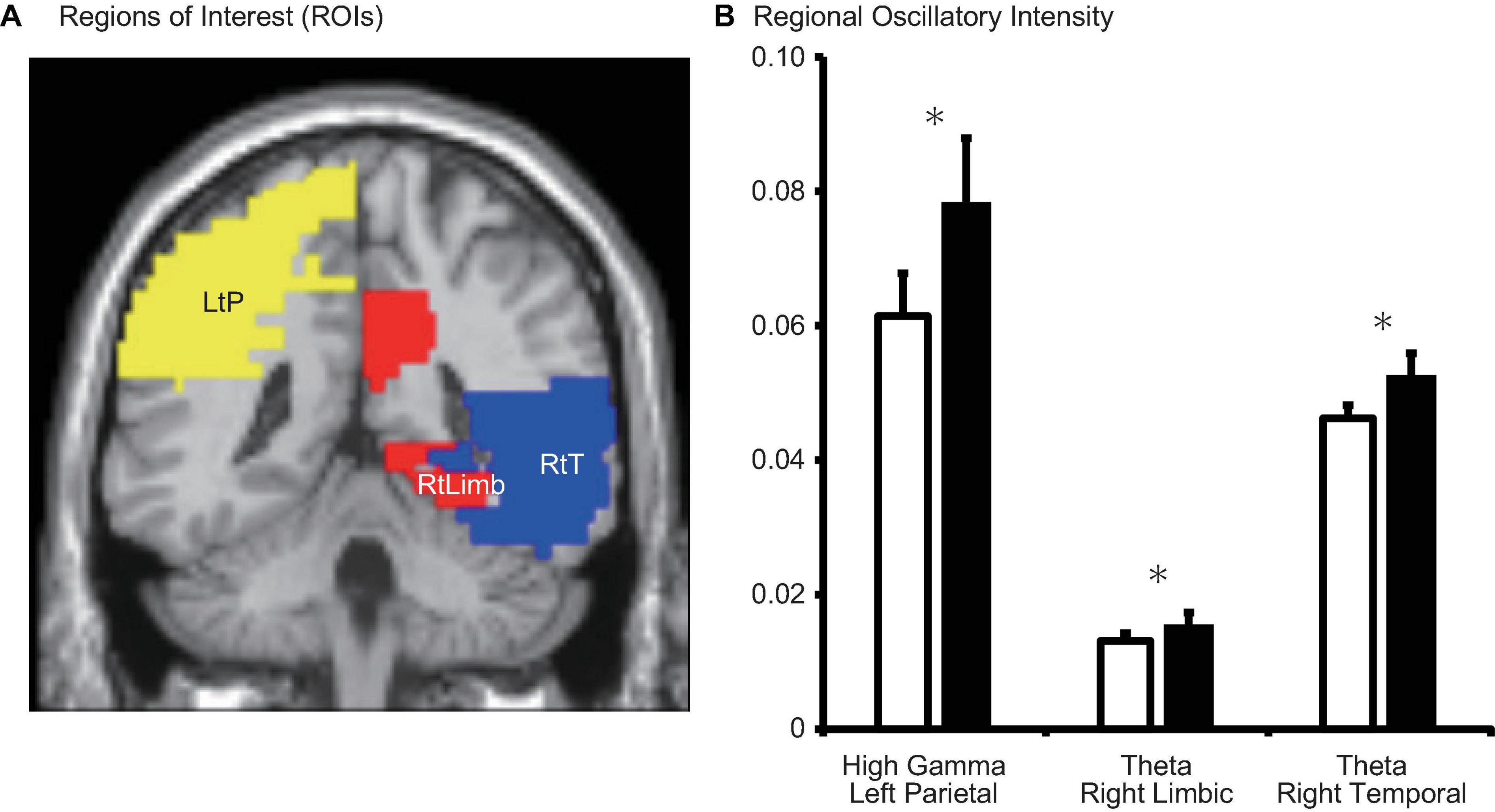 Human menstrual cycle variation in subcortical functional brain  connectivity: a multimodal analysis approach