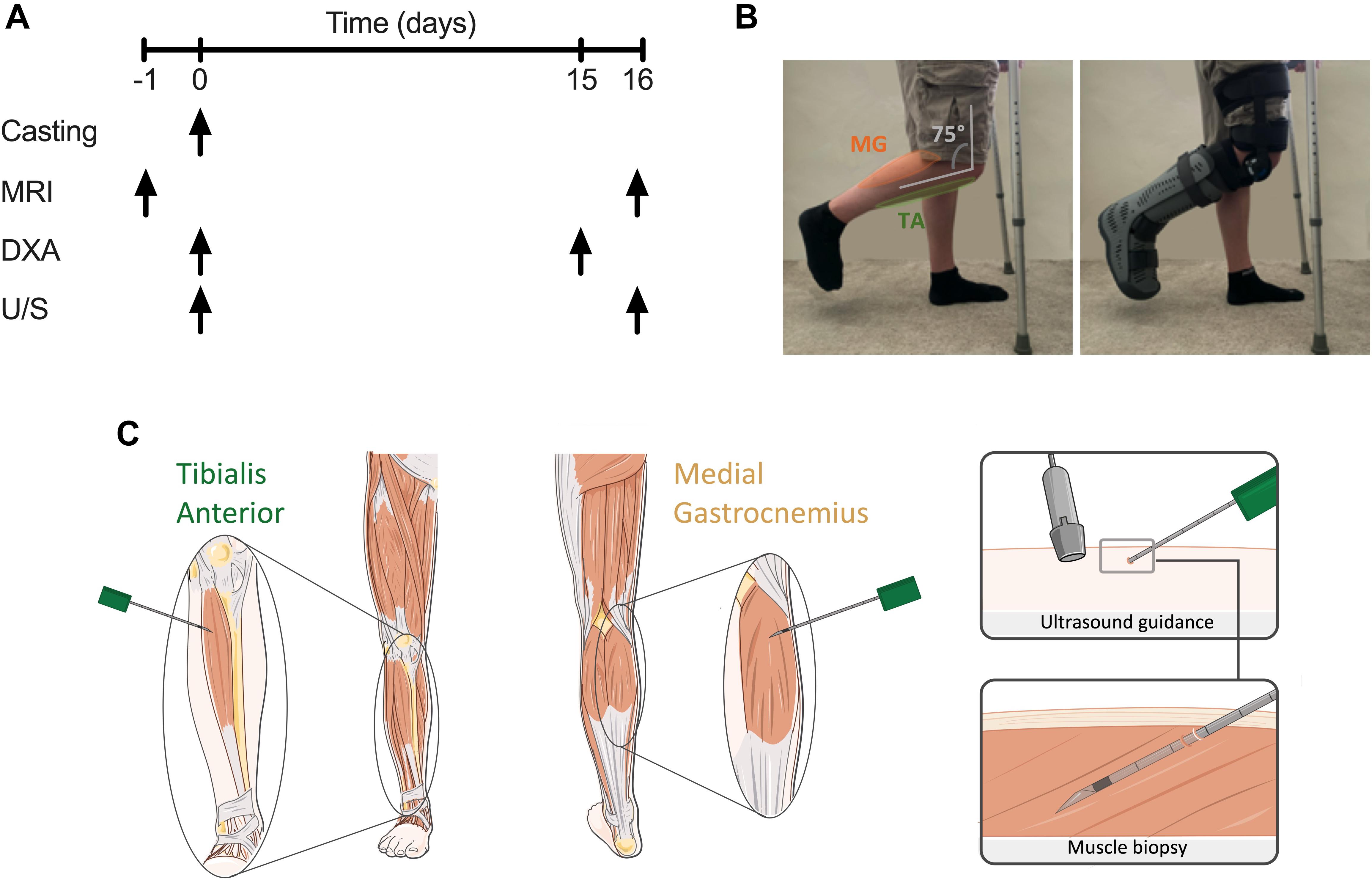 Lower limb compression garments worn by individuals in experimental