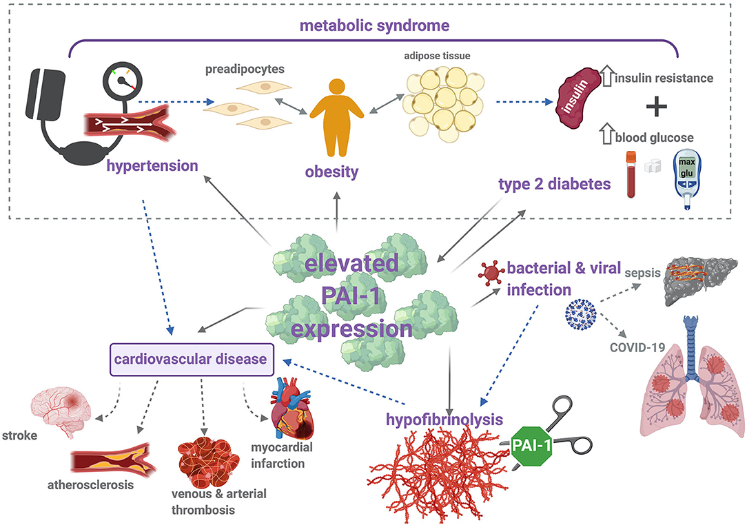 Plasminogen Activator Inhibitor-1 Is a Marker and a Mediator of