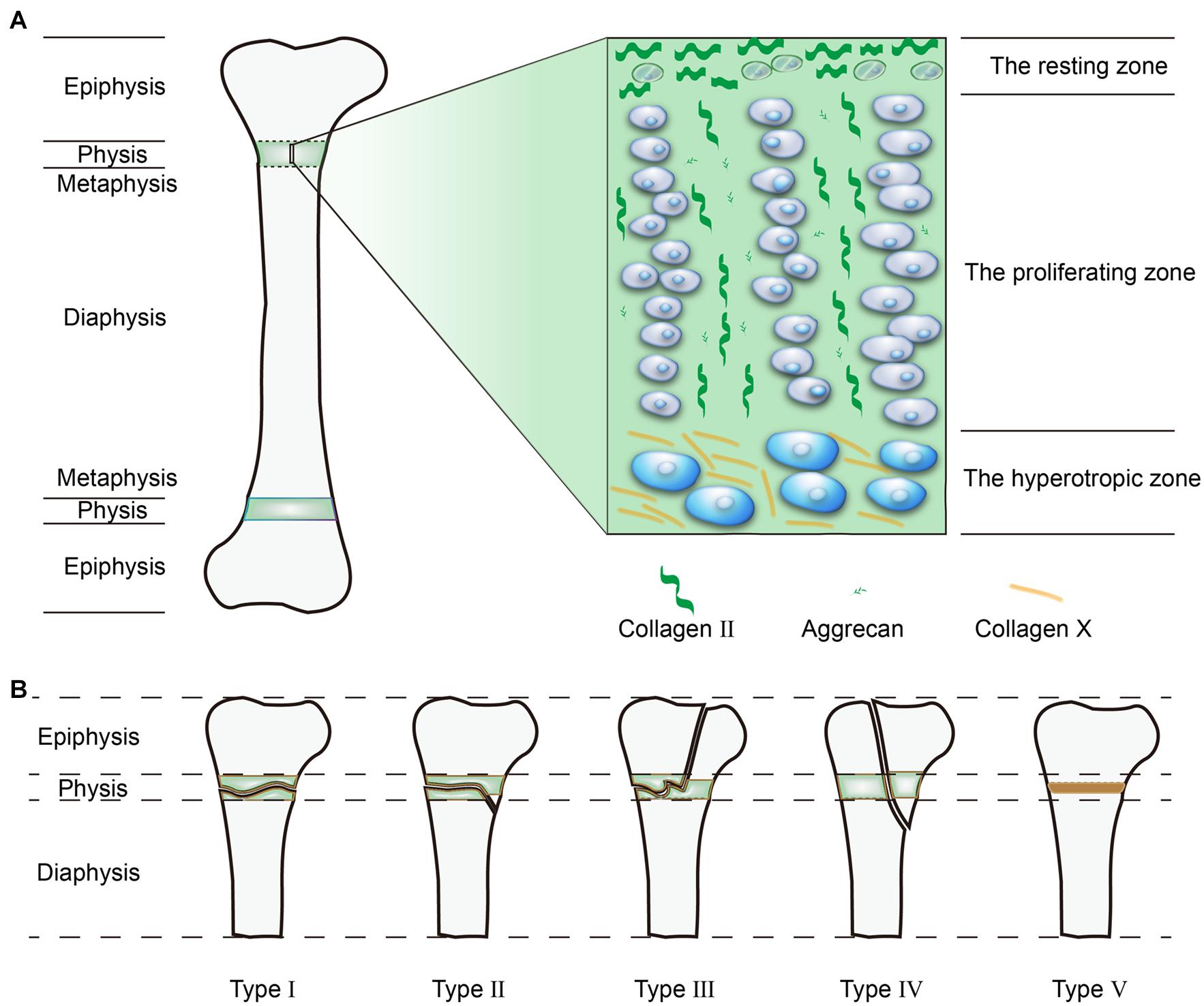 Frontiers | Enlightenment of Growth Plate Regeneration Based on 