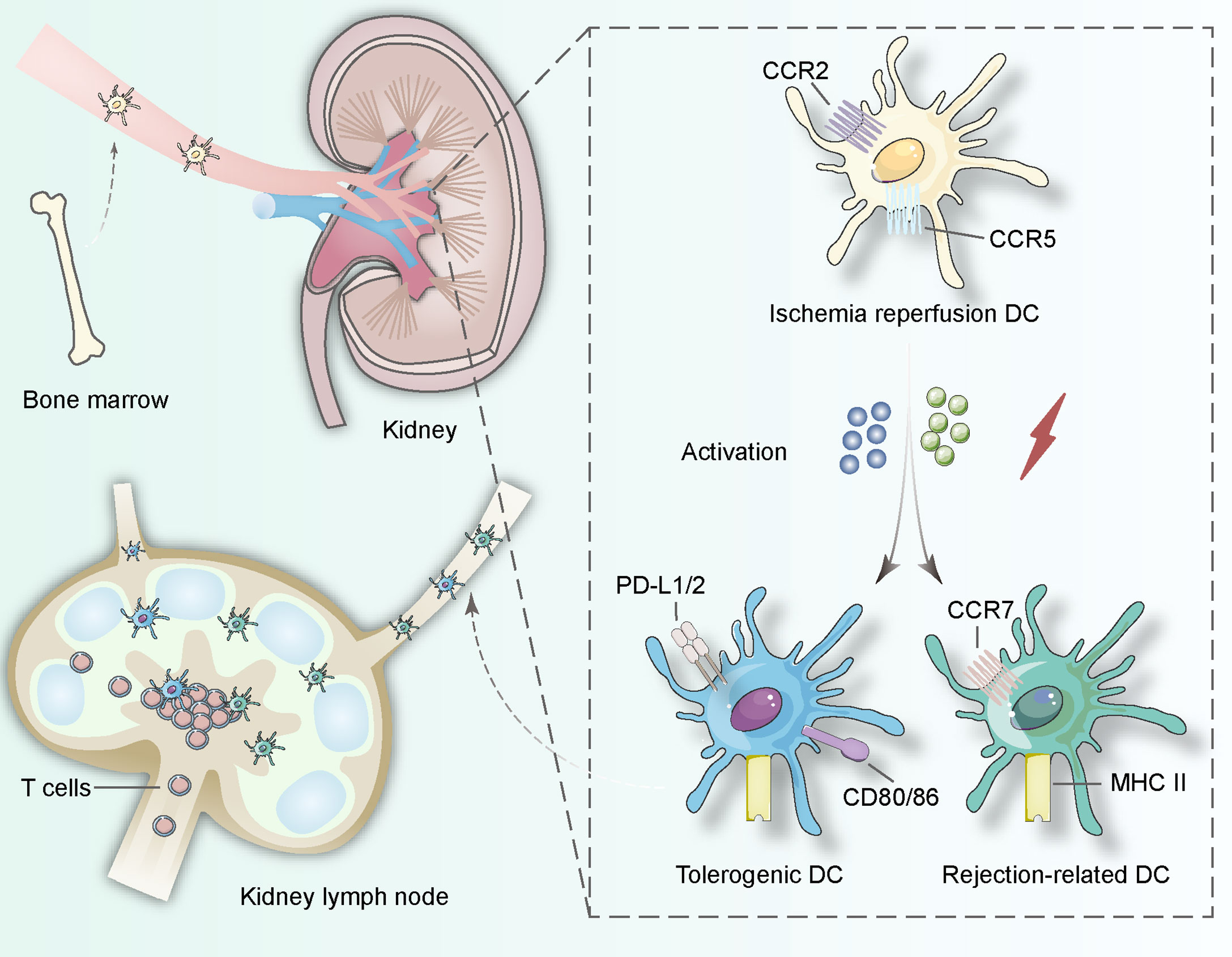 Frontiers Dendritic Cells Versatile Players In Renal Transplantation