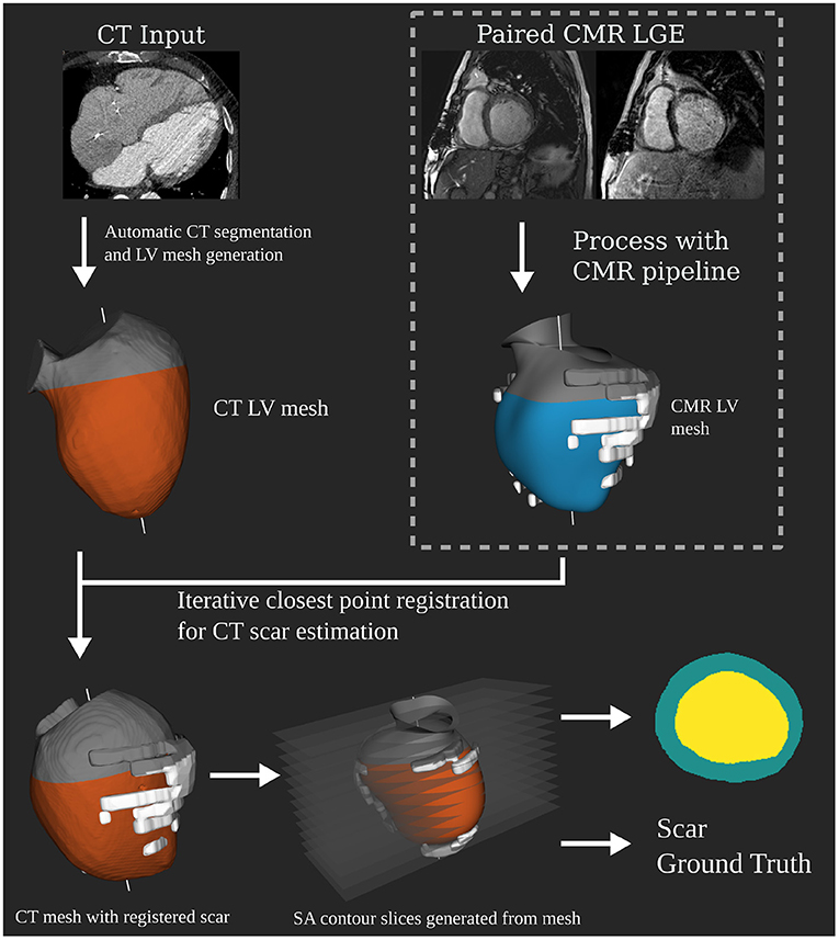 Frontiers  Automated Left Ventricle Ischemic Scar Detection in CT Using  Deep Neural Networks