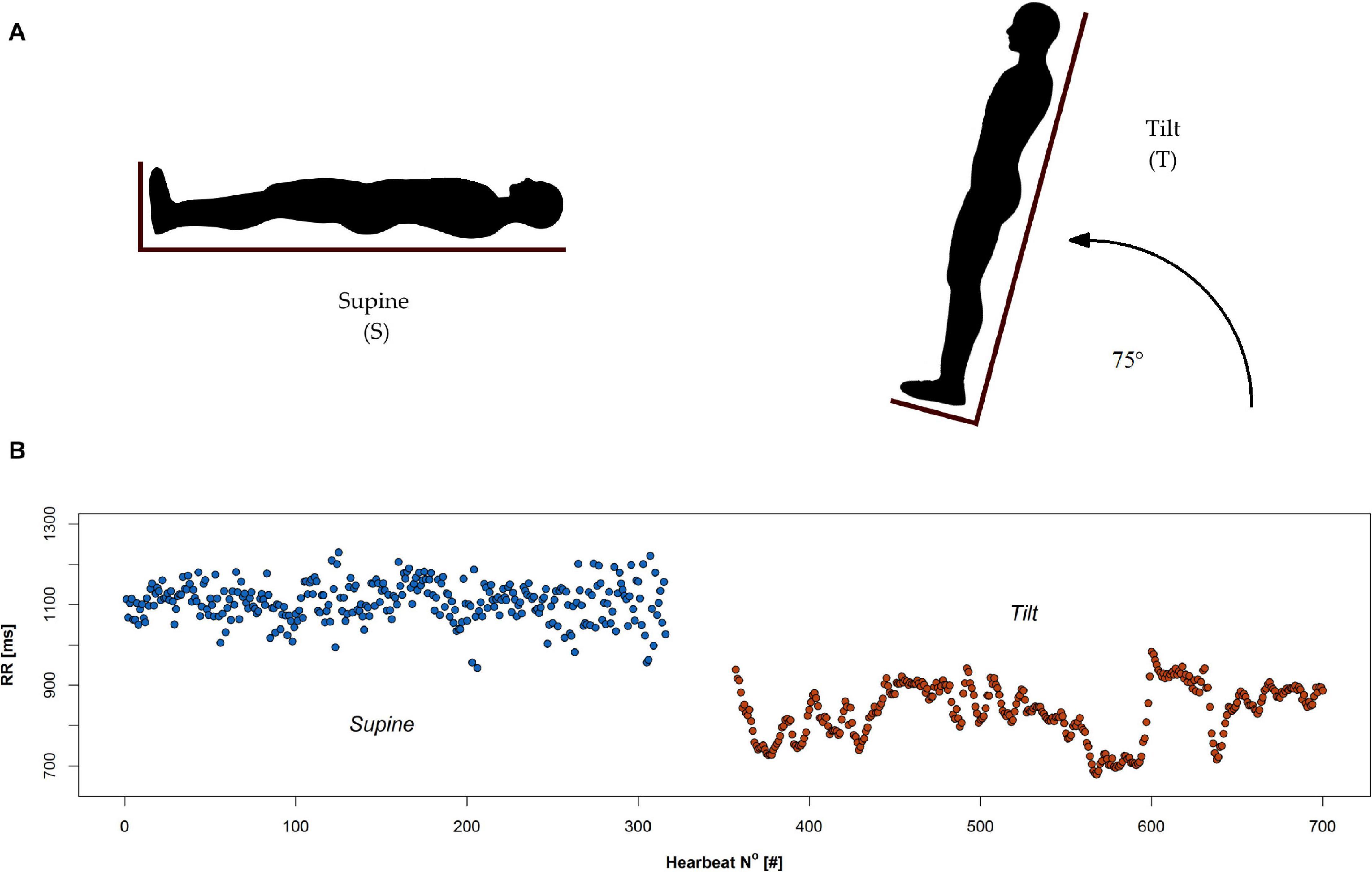 Study protocol for head-up tilt test (HUT).