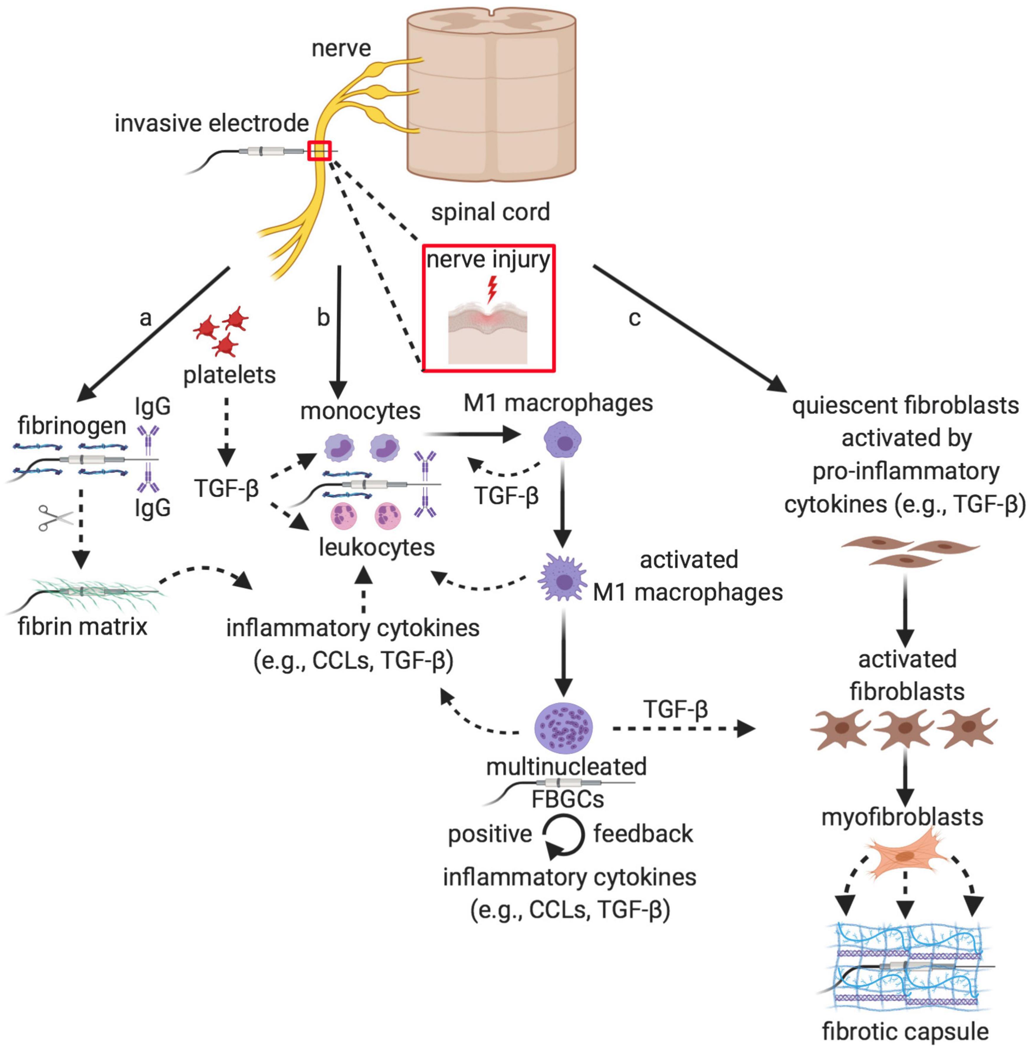 Frontiers  Foreign Body Reaction to Implanted Biomaterials and