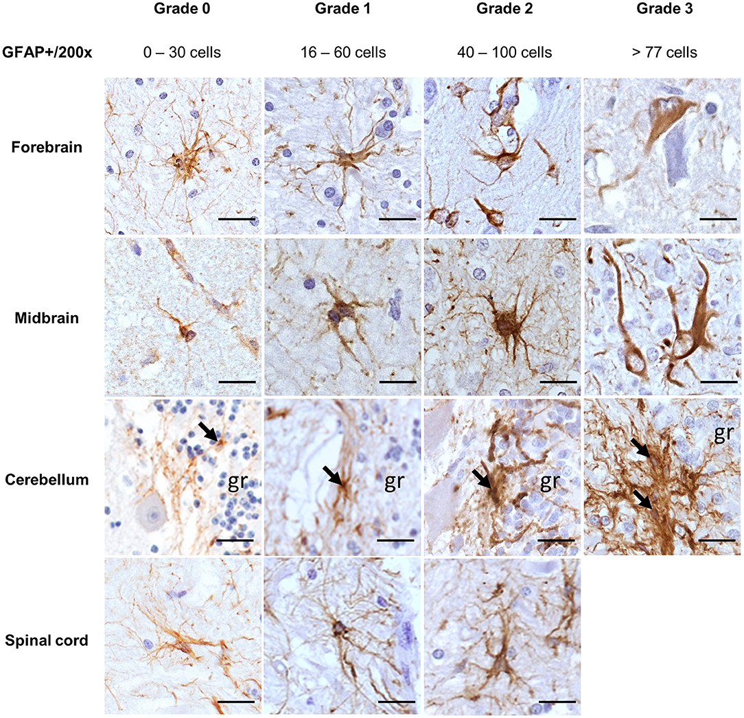 Frontiers | Glial Fibrillary Acidic Protein and Ionized Calcium-Binding  Adapter Molecule 1 Immunostaining Score for the Central Nervous System of  Horses With Non-suppurative Encephalitis and Encephalopathies