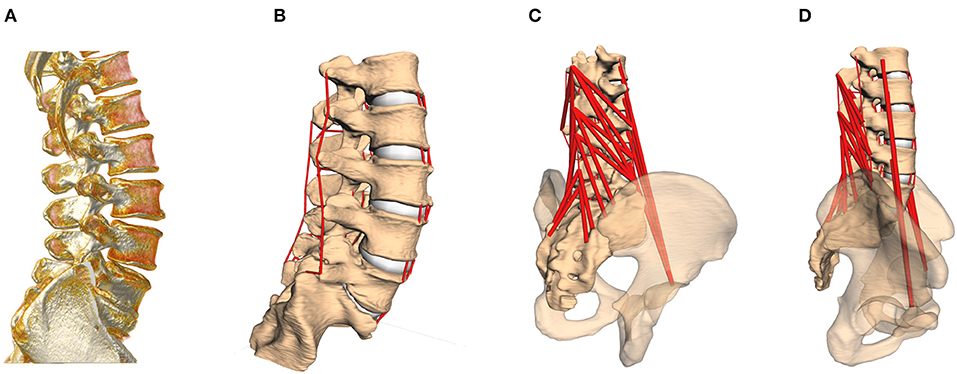 Lumbar Spine MRI scan - Medserena Open MRI