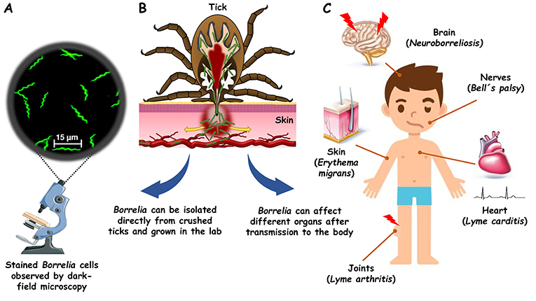 Figure 1 - (A) Borrelia isolated from ticks can be observed using a dark-field microscope.