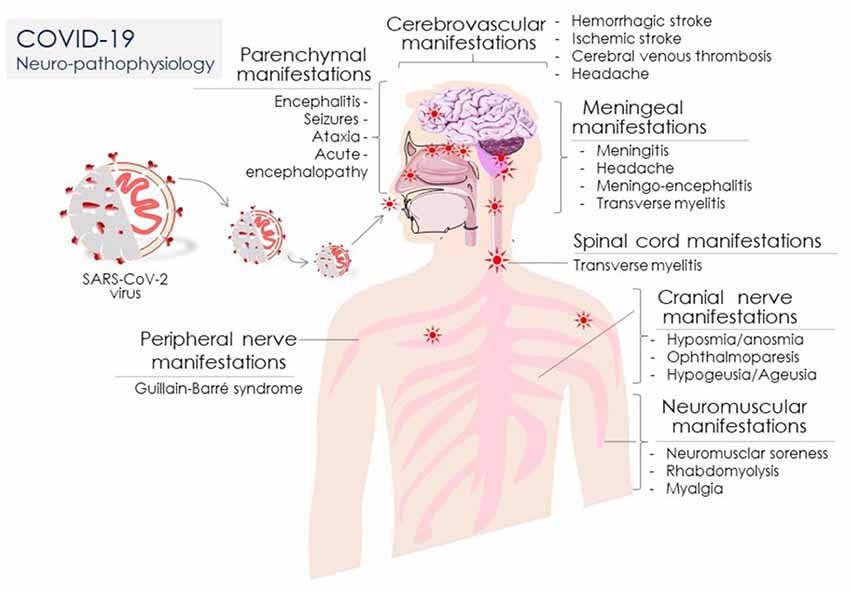 neuromuscular complications of covid 19 a review of the literature