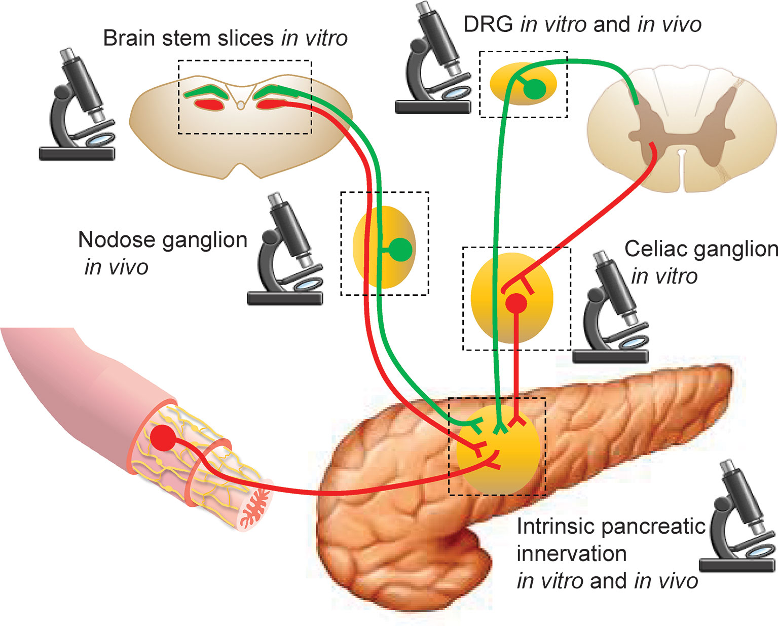 El pancrea se puede operar