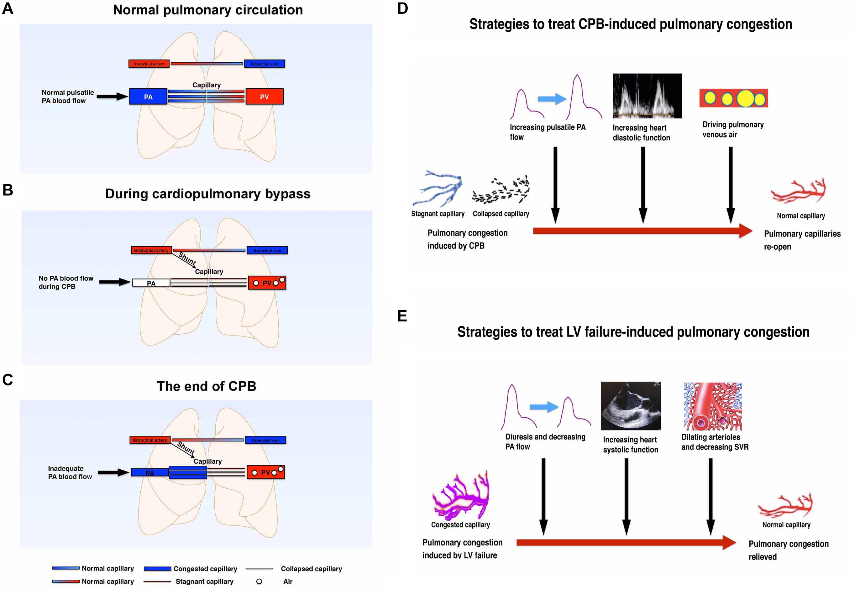 Braz J Cardiovasc Surg - The pulmonary vascular blood supply in