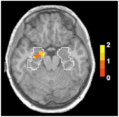 Figure 1 - An fMRI scan showing the difference in brain activity for odor-linked and picture-linked memories.