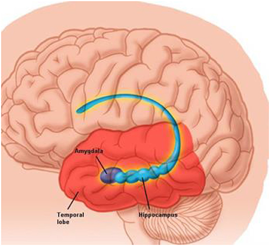 Figure 2 - The amygdala and hippocampus are located in the temporal lobes, with one on each side of the brain.