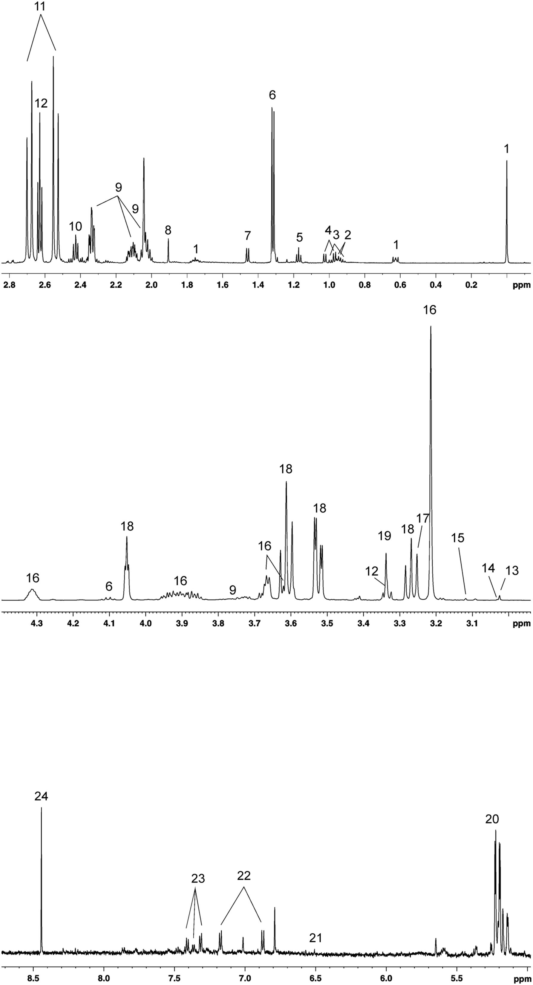 A 1D-NMR spectrum of CSF from a 30d pig, representative of all the