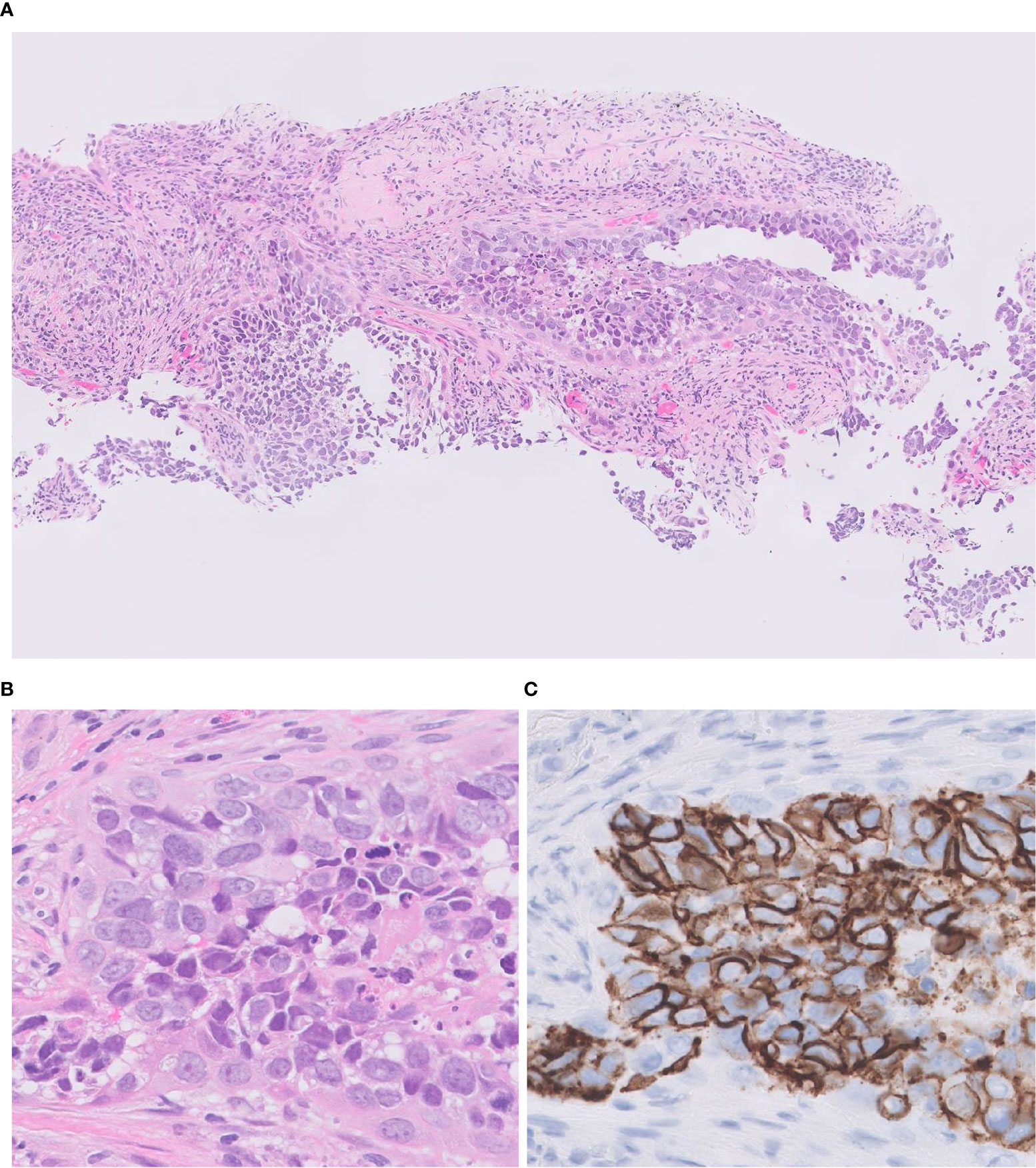 molecular pathology