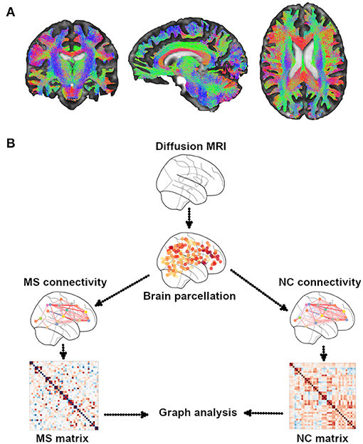 Frontiers Structural And Functional Connectivity Substrates Of Cognitive Impairment In Multiple Sclerosis Neurology