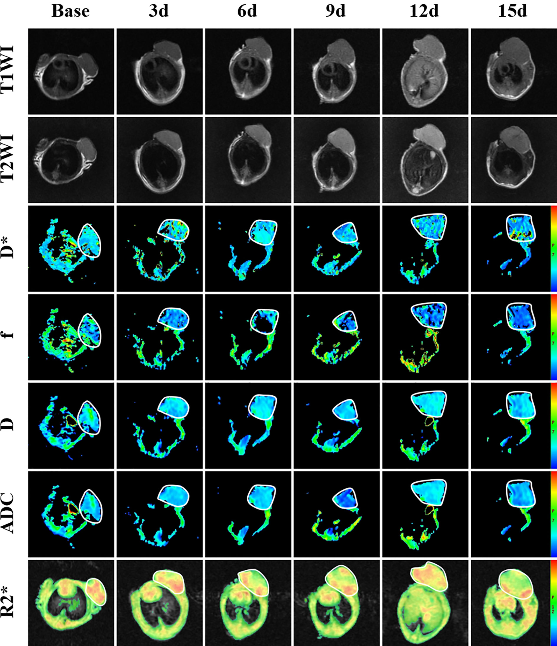 Frontiers | Monitoring Treatment Efficacy of Antiangiogenic Frontiers | Monitoring Treatment Efficacy of Antiangiogenic