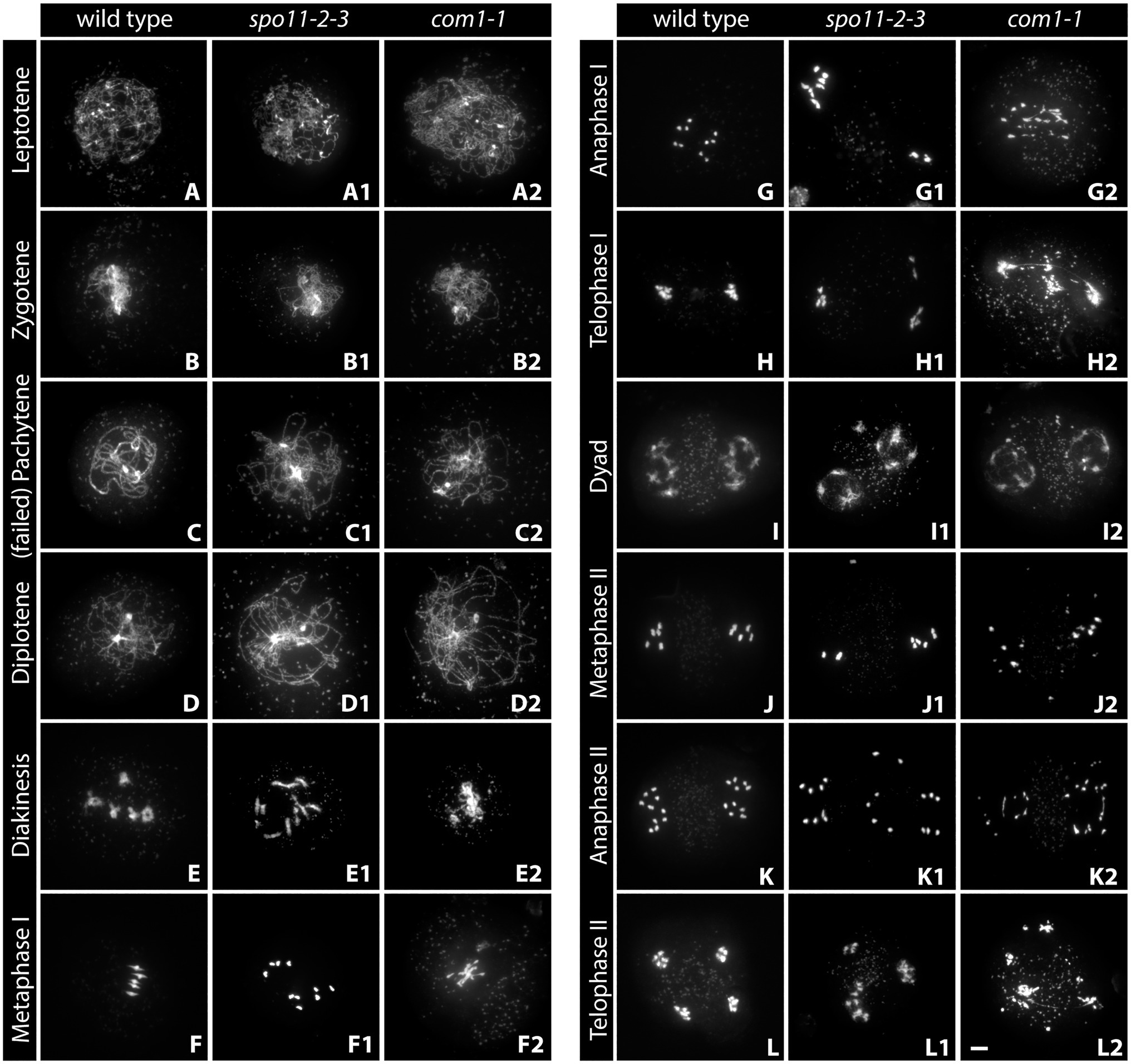 meiosis stages under microscope