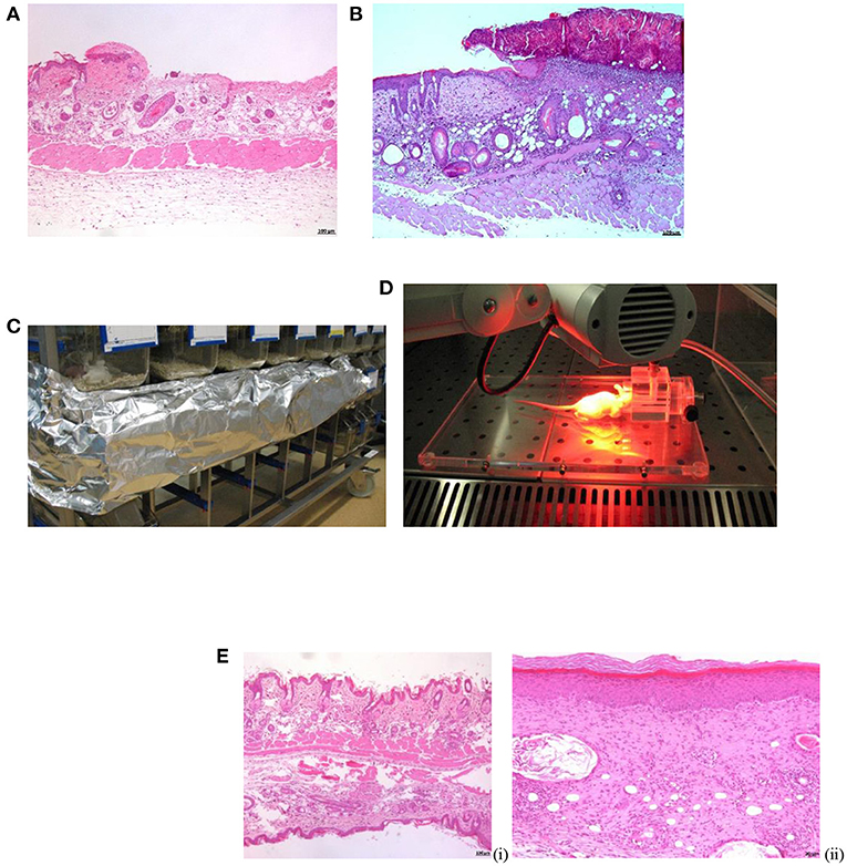 Treatment for S. aureus skin infection works in mouse model